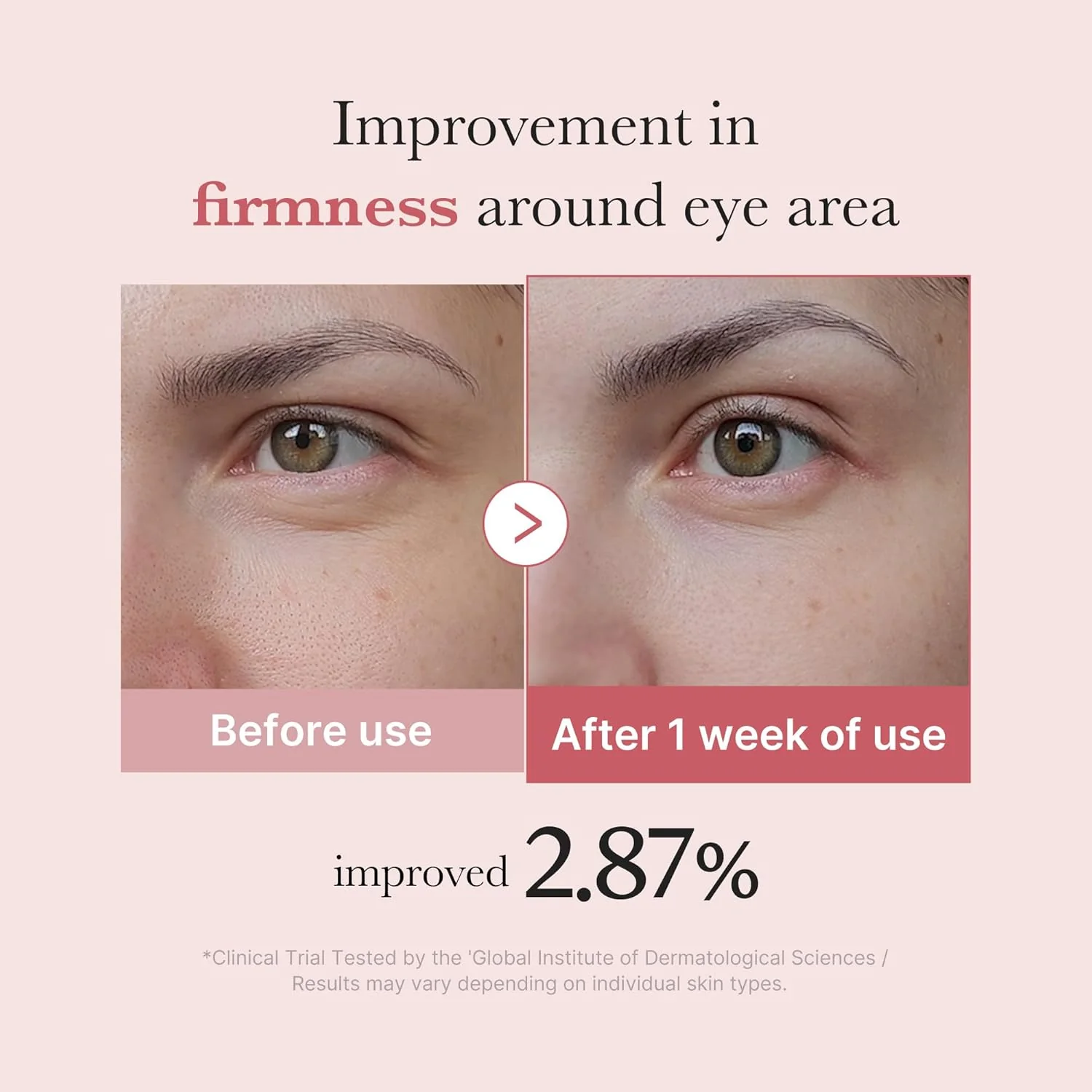 Medicube PDRN Pink Peptide Eye Cream - Κρέμα ματιών για ρυτίδες και μαύρους κύκλους - Image 4