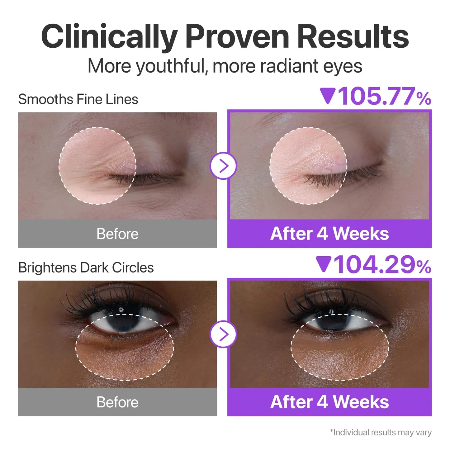 numbuzin No.9 NAD Retinol Volumetox Eye Cream - Συσφιγκτική Κρέμα Ματιών με NAD+ & Ρετινόλη για Λεία, Ξεκούραστη Όψη - Image 6