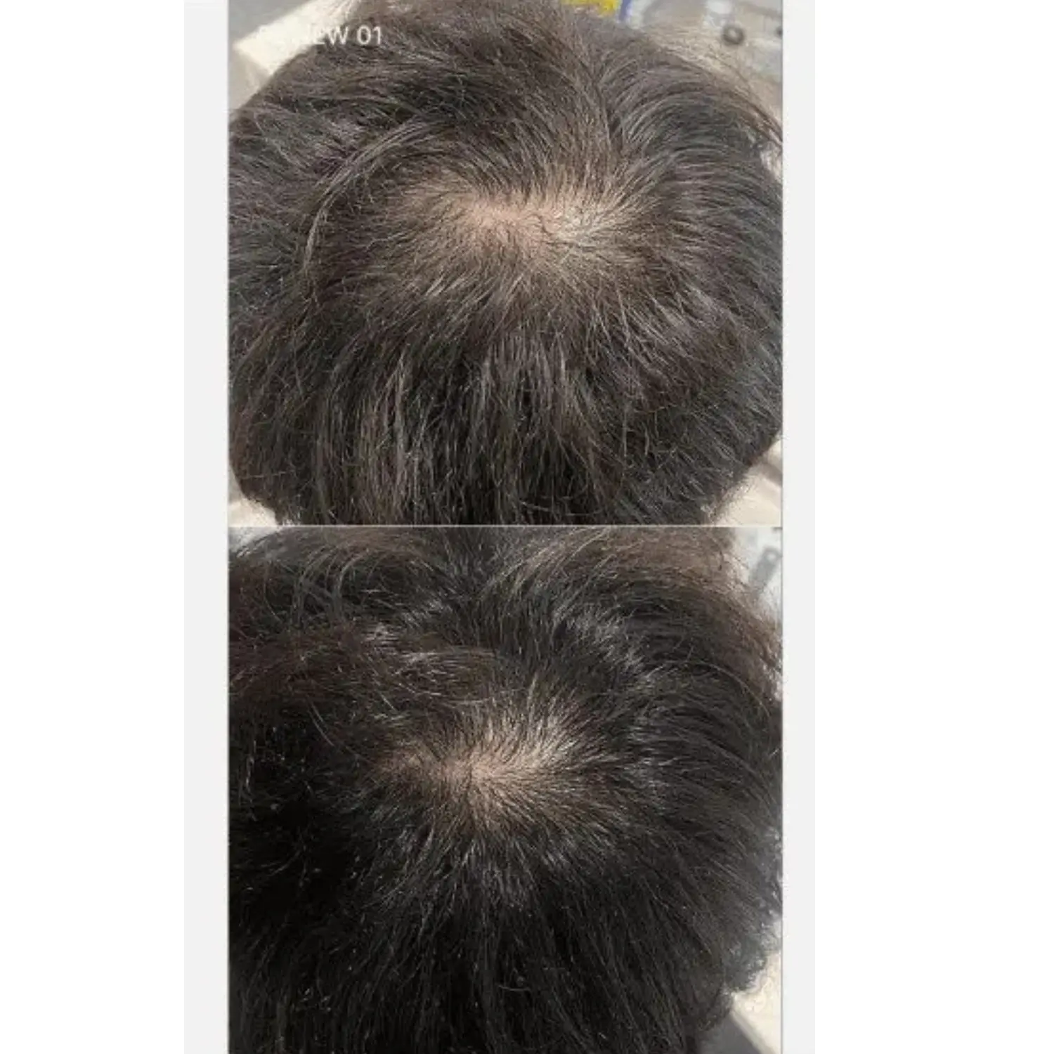 Medicube SOYXIDIL Shampoo - Σαμπουάν κατά της τριχόπτωσης - Image 5