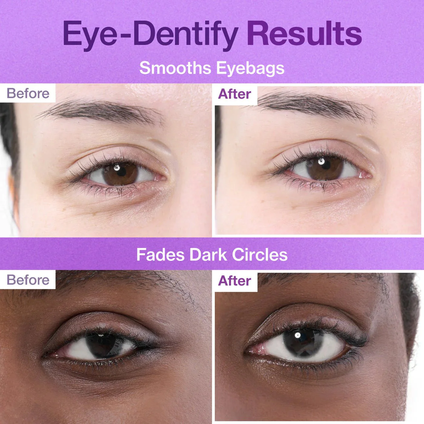 Numbuzin No.9 NAD Collagen Under Eye Patches - Eye Patches με Κολλαγόνο & 50 Πεπτίδια - Image 7